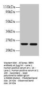 RBP4 Antibody