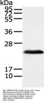 VHL Antibody