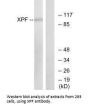 ERCC4 Antibody