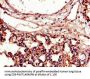 ICAM1 Antibody