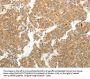 GEMIN2 Antibody