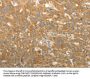GEMIN2 Antibody