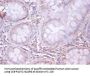 APP Antibody