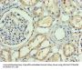 APP Antibody