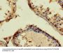 APP Antibody