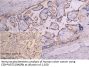 TFRC Antibody