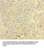 KDR Antibody