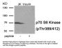 Phospho-RPS6KB1 (Thr389/412) Antibody