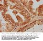 TGFB1 Antibody