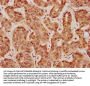 TGFB1 Antibody