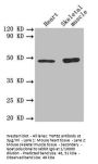 TGFB2 Antibody