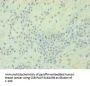 TGFB2 Antibody