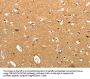TNR Antibody