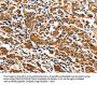 ITGAM Antibody