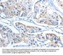 Rabbit anti-human ADSL polyclonal antibody