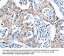 Rabbit anti-human ADSL polyclonal antibody