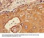 TIE1 Antibody