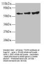 TIMP2 Antibody