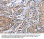 AGBL5 Antibody