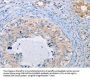AGBL5 Antibody