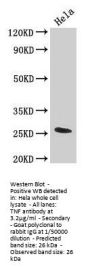 TNF Antibody