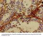 TNF Antibody