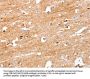 S100B Antibody