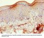 MMP3 Antibody