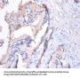 MMP7 Antibody