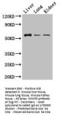 MMP8 Antibody