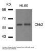 CHEK2 (Ab-516) Antibody