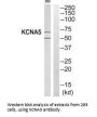 KCNA5 Antibody