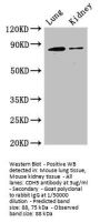 CDH5 Antibody