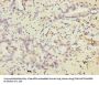 VEGFC Antibody