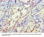 INHBA Antibody