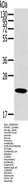 OTUB2 Antibody