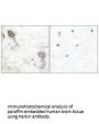 PARK2 Antibody