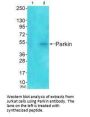 PARK2 Antibody