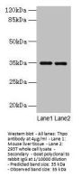 Thpo Antibody
