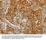 CEACAM8 Antibody