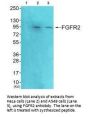FGFR2 Antibody
