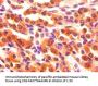 FABP3 Antibody