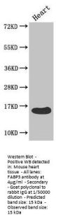 FABP3 Antibody