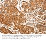 TPM2 Antibody