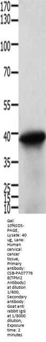 TPM2 Antibody