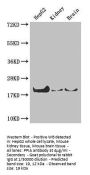PPIA Antibody