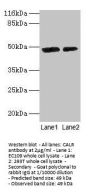 CALR Antibody