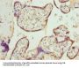 CALR Antibody
