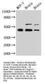 TP53 Antibody