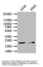 NPPB Antibody